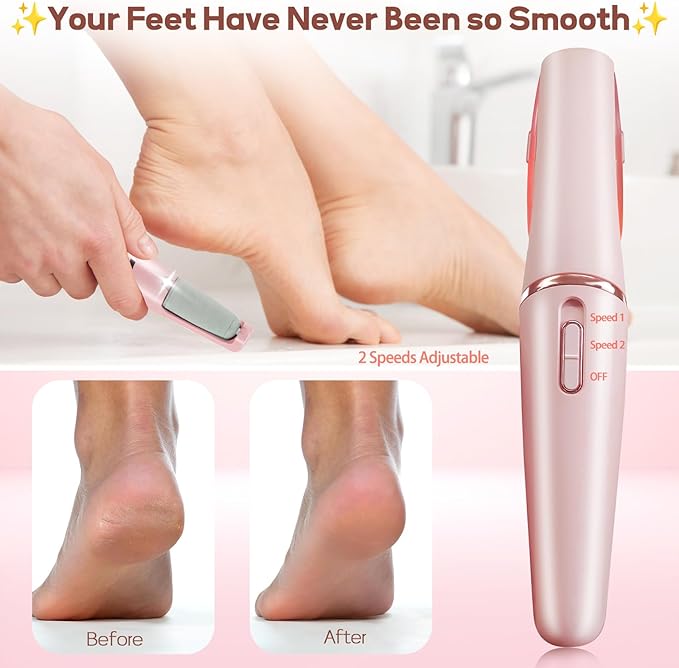 Extracteur de Callosités Électrique pour les Pieds - Pedicure professionnelle a domicile