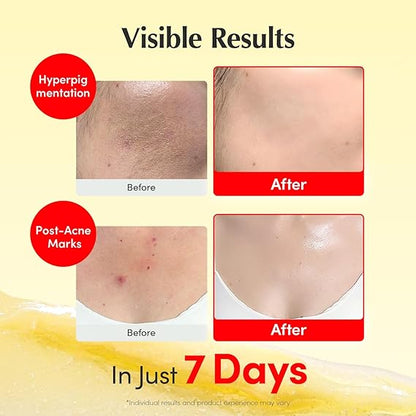 Concentré Éclat Vitamine C – Anti-Imperfections & Anti-Âge